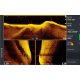 Transductor Active Imaging HD 3 in 1 H/W SideScan FISHREVEAL