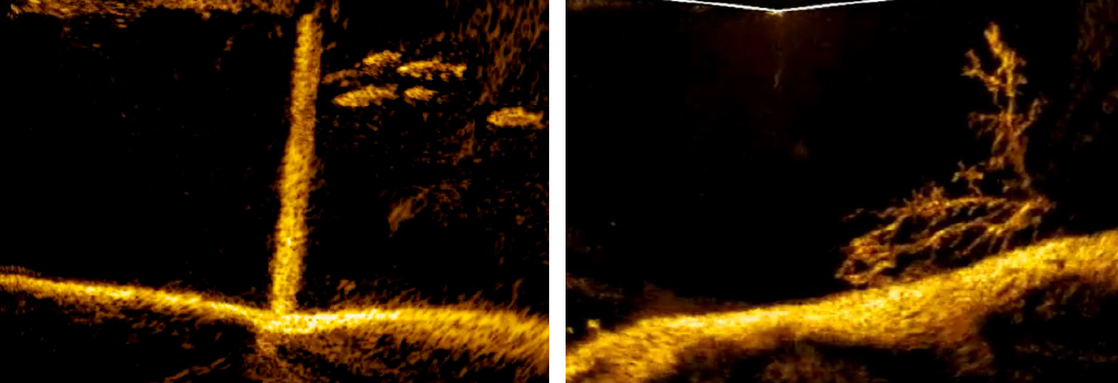 ActiveTarget 2 XL Modulo con Transductor Lowrance. ONNautic